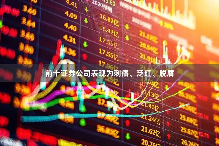 前十证券公司表现为刺痛、泛红、脱屑